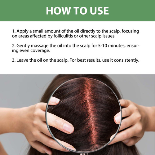 Olive Scalp Repair Alivia A Vermelhidão E A Coceira Do Couro