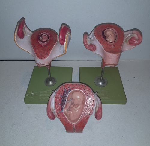 Utero Con Feto Gestacion 3 Modelos Anatomia Somso Alemania (Usado)