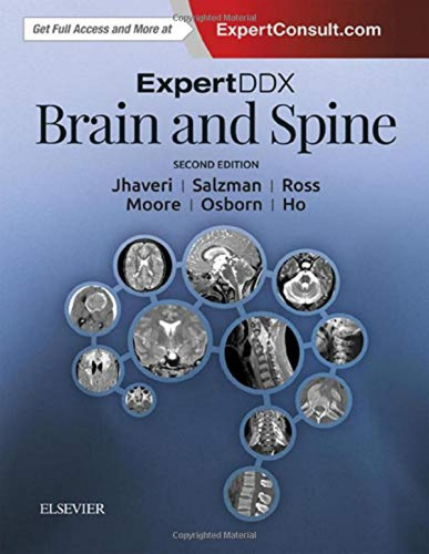 Expertddx: Brain And Spine.(2nd Edition)