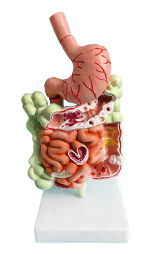 Modelo Del Sistema Digestivo Humano Anatomía Del Estomago In