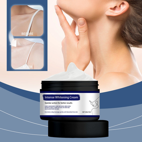 La Crema T Elimina Las Manchas Oscuras, Blanquea El Cuerpo Y
