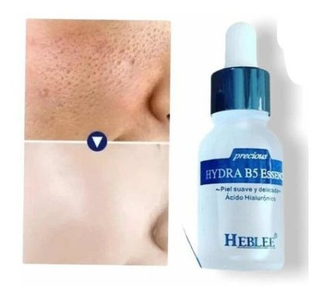 Imagen 1 de 3 de Ácido Hialurónico Hydra B5 Essence Antiarrugas Marca Heblee.
