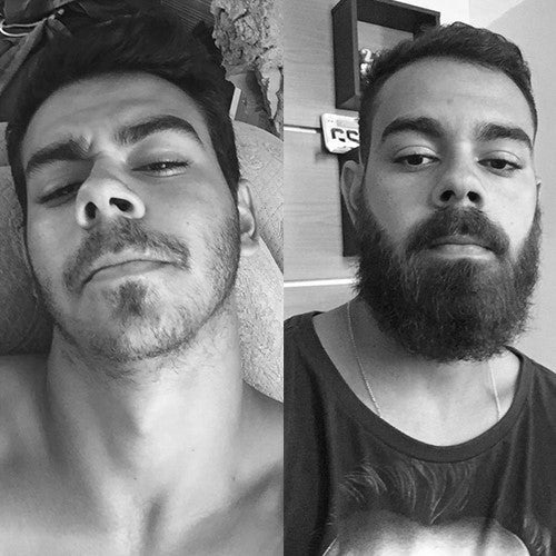 Produto Para Crescer Barba Tonico Crescimento Respeito Blend Menthol Ativo