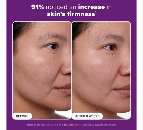 Crema Tratamiento Retinol 1% Con Péptidos Y Vitamina C -