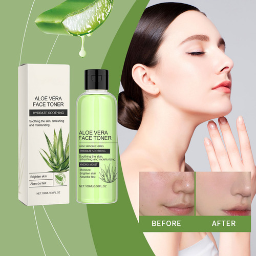 ! Loción Calmante U Aloe Vera Que Calma Y Repone La Humedad