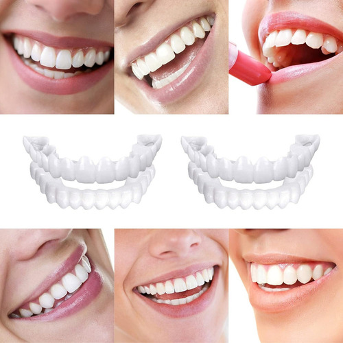 A 4 Facetas Dentárias De Pressão Para Homens E Mulheres, 4