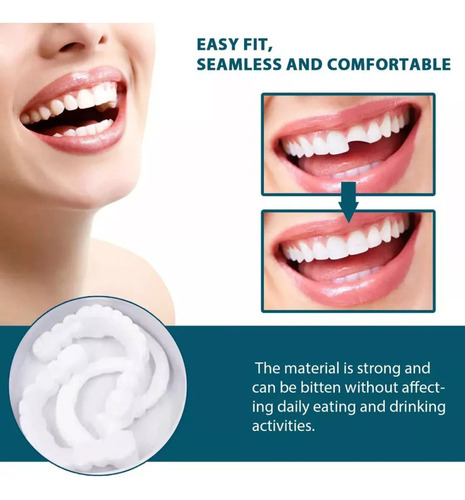 Soportes De Montaje Ajustables Para Dentaduras Temporales