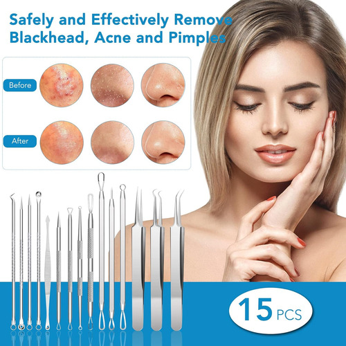 Removedor De Espinillas, Kit De Herramientas Para Extraer Es