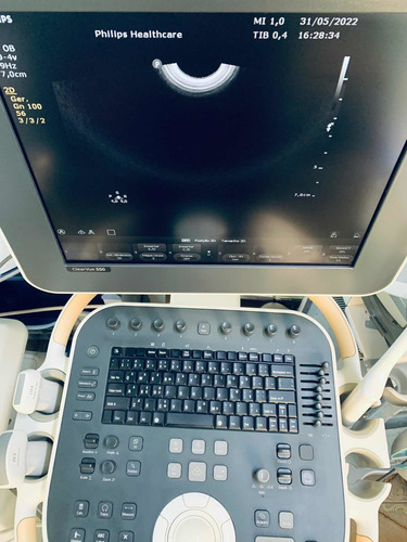 Ultrassom Philips Clearvue 550 Gineco Obstetrícia Vascular
