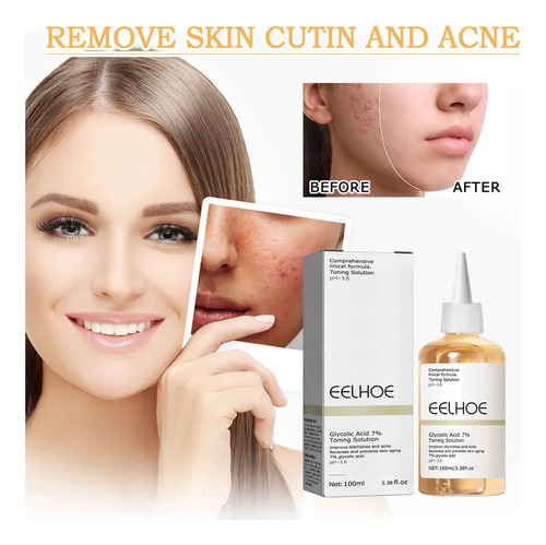 1×exfoliante Facial Con Ácido Glicólico 7%, Astringe Los Po
