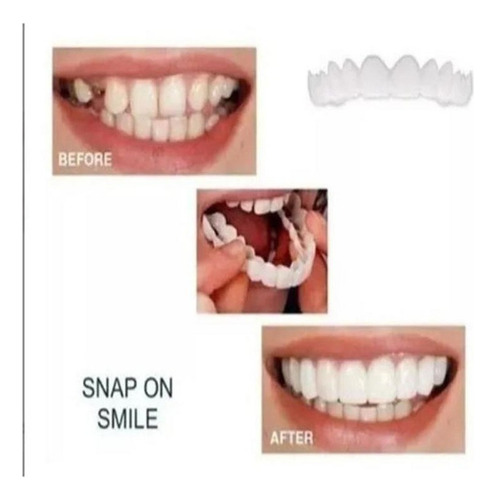 Mox Silicona Superior/inferior Sorriso Dentes Falsos
