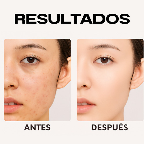 Set Facial Vitamina C Antimanchas Hidratante Rejuvenecedor