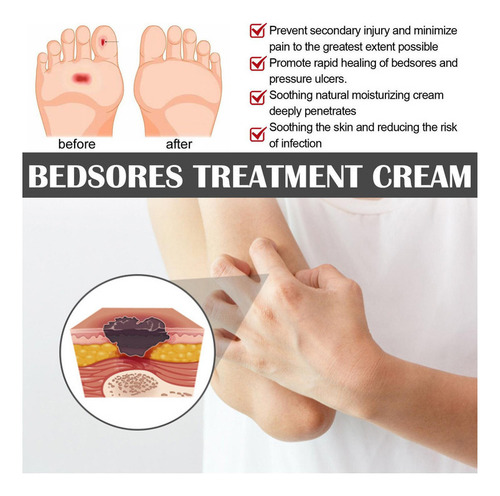 5x Crema For Llagas Por Presión Ungüento For Escaras