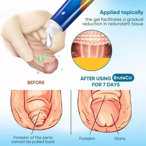 Gel Corrector De Prepucio Bruteco Redundant, 3 Unidades