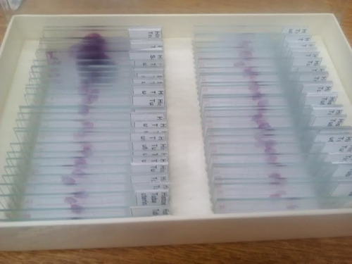 Imagem 1 de 4 de 80 Laminas Preparadas Ensino Universsitario