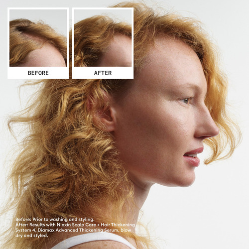 Shampoo E Condicionador Nioxin System 4 Para Cabelos Tingido