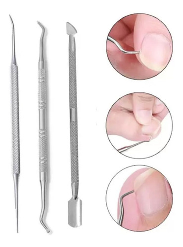 Imagem 5 de 10 de Kit Desencravador De Unhas Espátula Palito Raspador Mão Pé