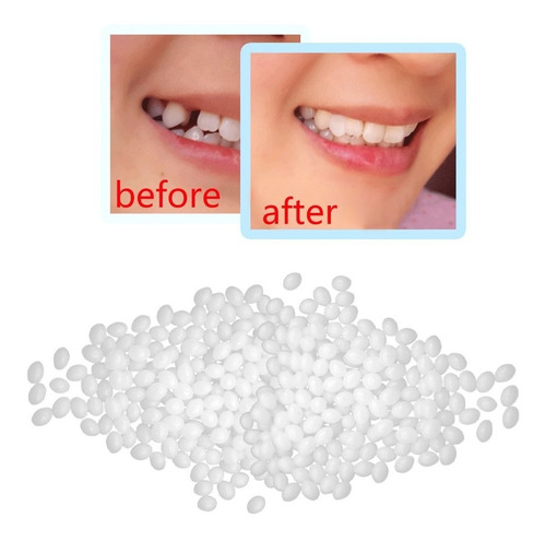 Imagen 2 de 9 de Kit De Reparación Temporal De Dientes Y Huecos Dientes False