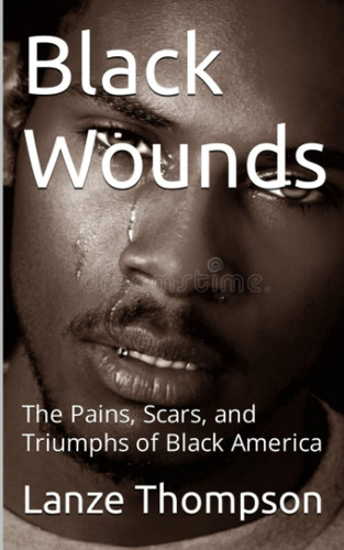 Libro: Black Wounds: The Pains, Scars, And Triumphs Of Black