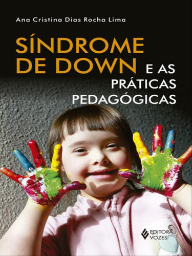 Síndrome De Down E As Práticas Pedagógicas, De Lima, Ana Cristina Dias Rocha. Editora Vozes, Capa Mole Em Português