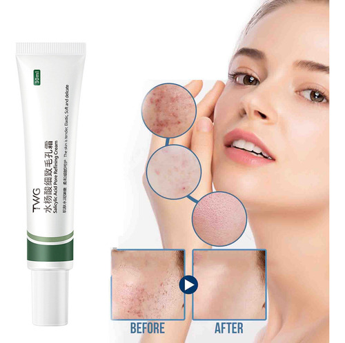 Xx Crema Retráctil Crema Salicílica 30 Ml Acid Pore