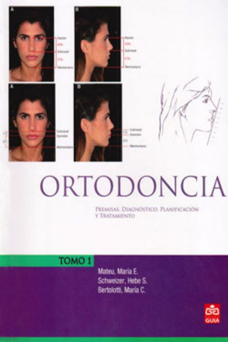 Ortodoncia, Premisas Para Diagnostico Planificación, Mateu