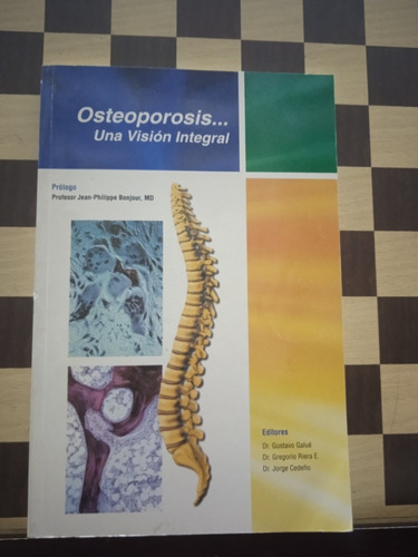 Osteoporosis Una Visión Integral