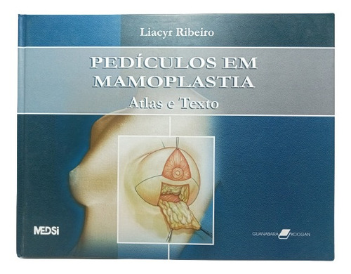 Pedículos En Mamoplastia - Liacyr Ribero - Ed Guanábana Koog