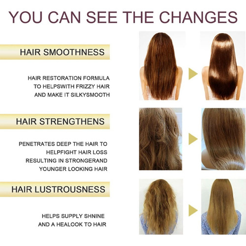 . 4x Shampoo Natural Stick Para Parar A Queda De Cabelo