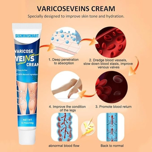 Crema Para Venas Varicosas