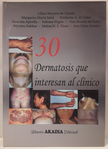 30 Dermatosis Que Interesan Al Clinico - Liliana Moyano