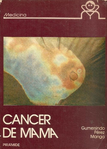 Libro Cancer De Mama De Gumersindo Perez Manga