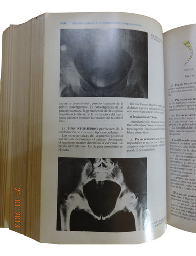 Anatomía Humana Latarjet 3ra Edición Volumen I Y Ii (Usado)