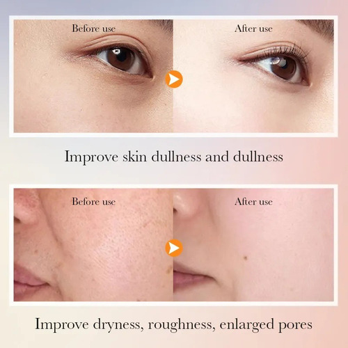 Kit Vitamina C 5x Sadoer Facial Aclarante Hidratante 6 En 1 Todo Tipo De Piel Día/noche