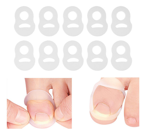 10 Uds. De Silicona Para Corregir Las Uñas Encarnadas,