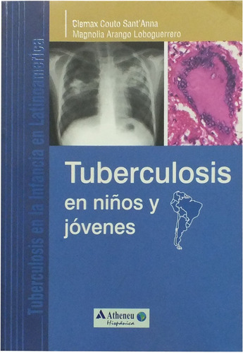 Tuberculosis en niños y jóvenes, de Sant'Anna, Clemax Couto. Editora Atheneu Ltda, capa mole em español, 2011