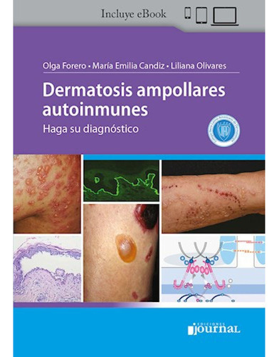 Dermatosis Ampollares Autoinmunes: Haga Su Diagnóstico