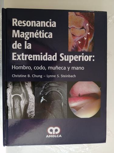 Resonancia Magnetica Extremidad Superior,hombro,codo,muñeca 