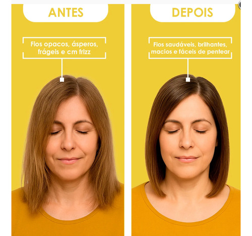 Shampoo Evitar A Queda, Além De Hidratar E Proteger Os Fios