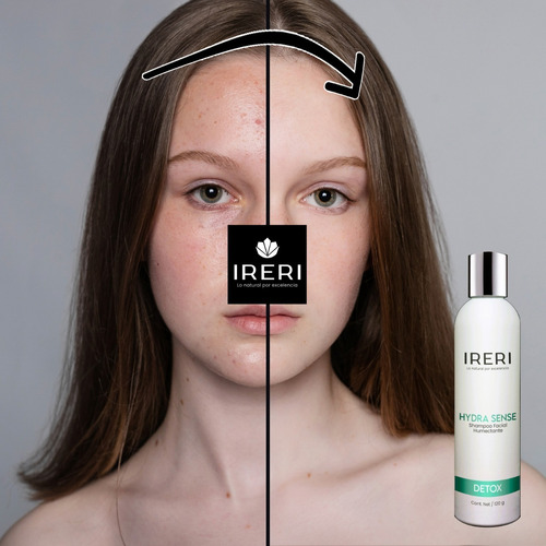 Imagen 8 de 9 de Shampoo Dermo Limpiador Facial Humectante Hidratante Detox