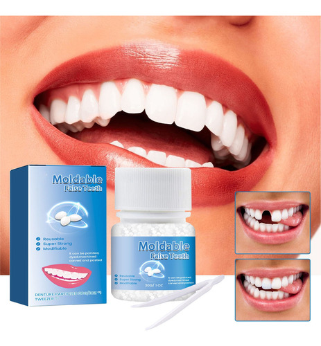 Kit De Reparo De Dentes Que Conserta O Dente Perdido E Quebr