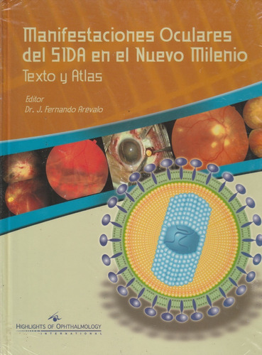 Manifestaciones Oculares Del Sida En El Nuevo Milenio. Texto