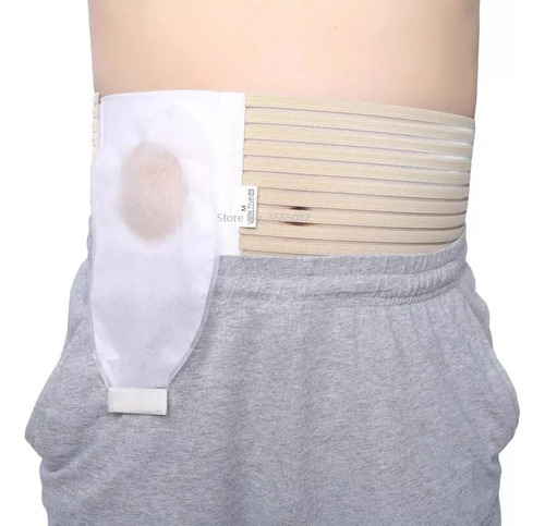 Cinturón Abdominal De Colostomía Talla S-xl Para Estoma Fijo