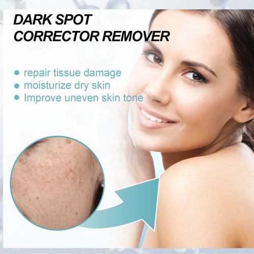 Crema Correctora E Antimanchas Para Rostro Y Cuerpo Age S