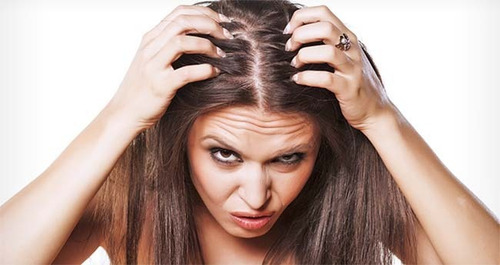 Imagen 5 de 7 de Shampoo Caída Laca