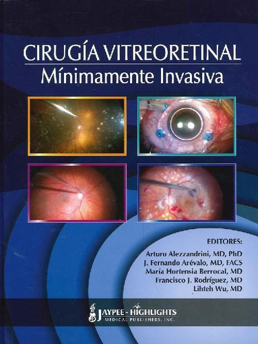 Libro Cirugía Vitreoretinal Mínimamente Invasiva De Arturo A