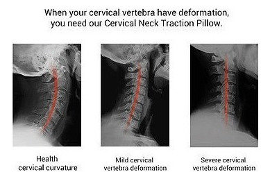 Magic Neck Support Dispositivo De Tracción Cervical Traction
