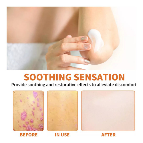 5×crema Para Tratamientos Psoriasis Con Venenos Abeja