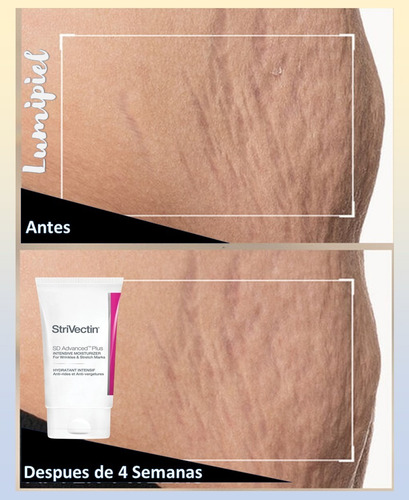 Strivectin Sd Advanced Plus Intensive Moisturizer 47ml Todo Tipo De Piel Día/noche
