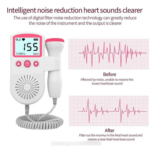 Doppler Fetal Lcd Ultrasonico Frecuencia Cardiaca Embarazo